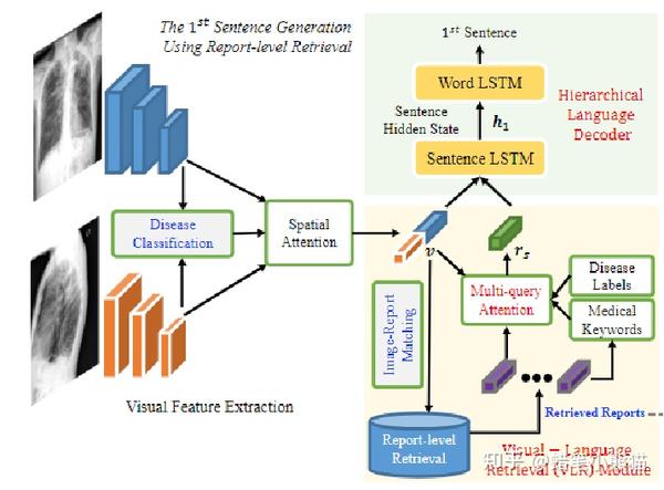 ACL21论文解读Writing by Memorizing Hierarchical Retrievalbased Medical