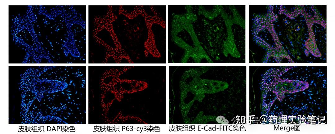 免疫荧光图怎么看?从荧光颜色、蛋白定位到定量分析,一文搞懂读图方法 - 知乎
