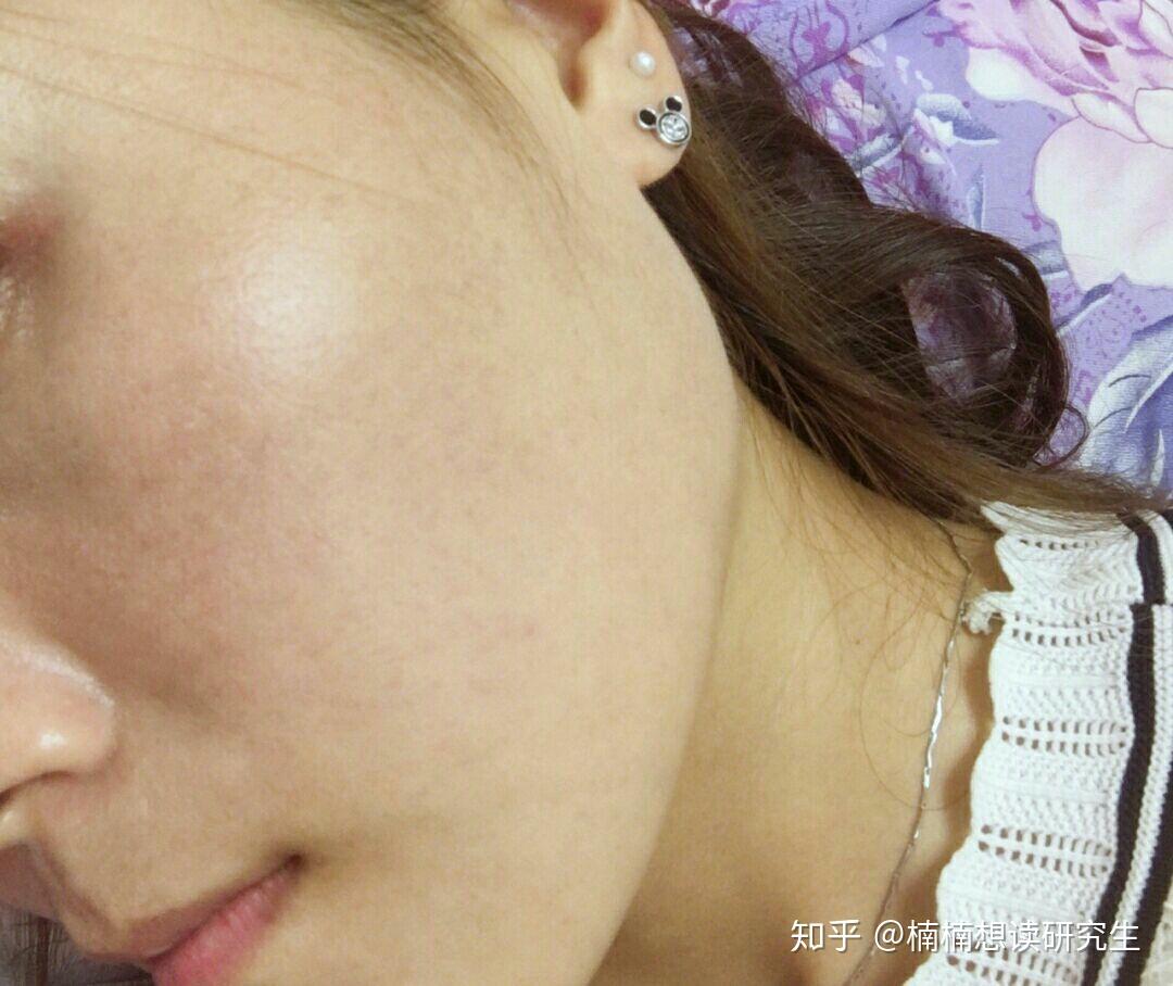 皮肤修复屏障最好的产品 v2-4232ce740ae7bb0b785d7c3901ad73d3_r.jpg