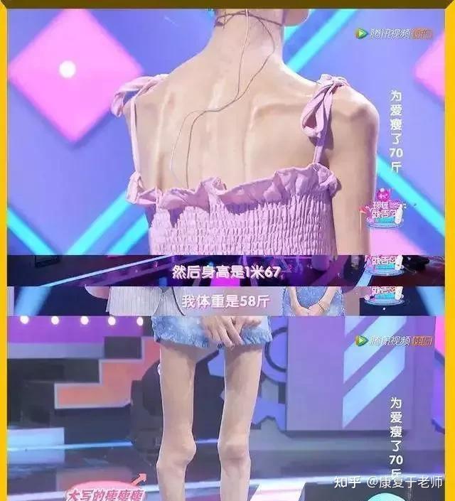 改掉含胸驼背自信的你最美