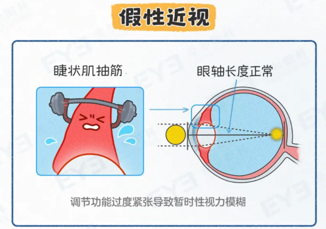 眼科教授王艳青主任医师：孩子验光有必要散瞳吗？会不会伤害眼睛？ - 知乎