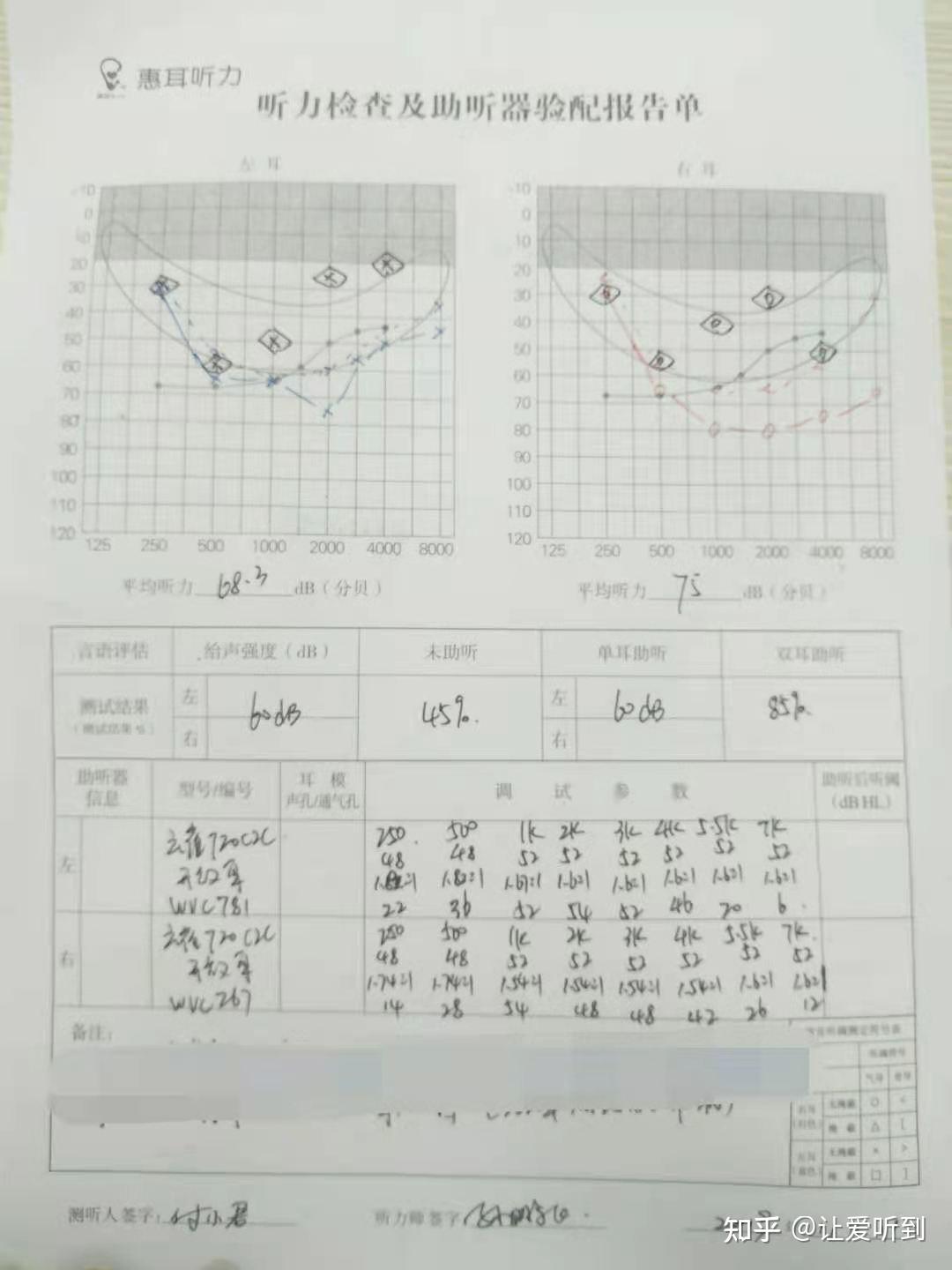 无流脓史和手术史,耳聋家族和遗传病史她不确定(她的孩子听力正常,无