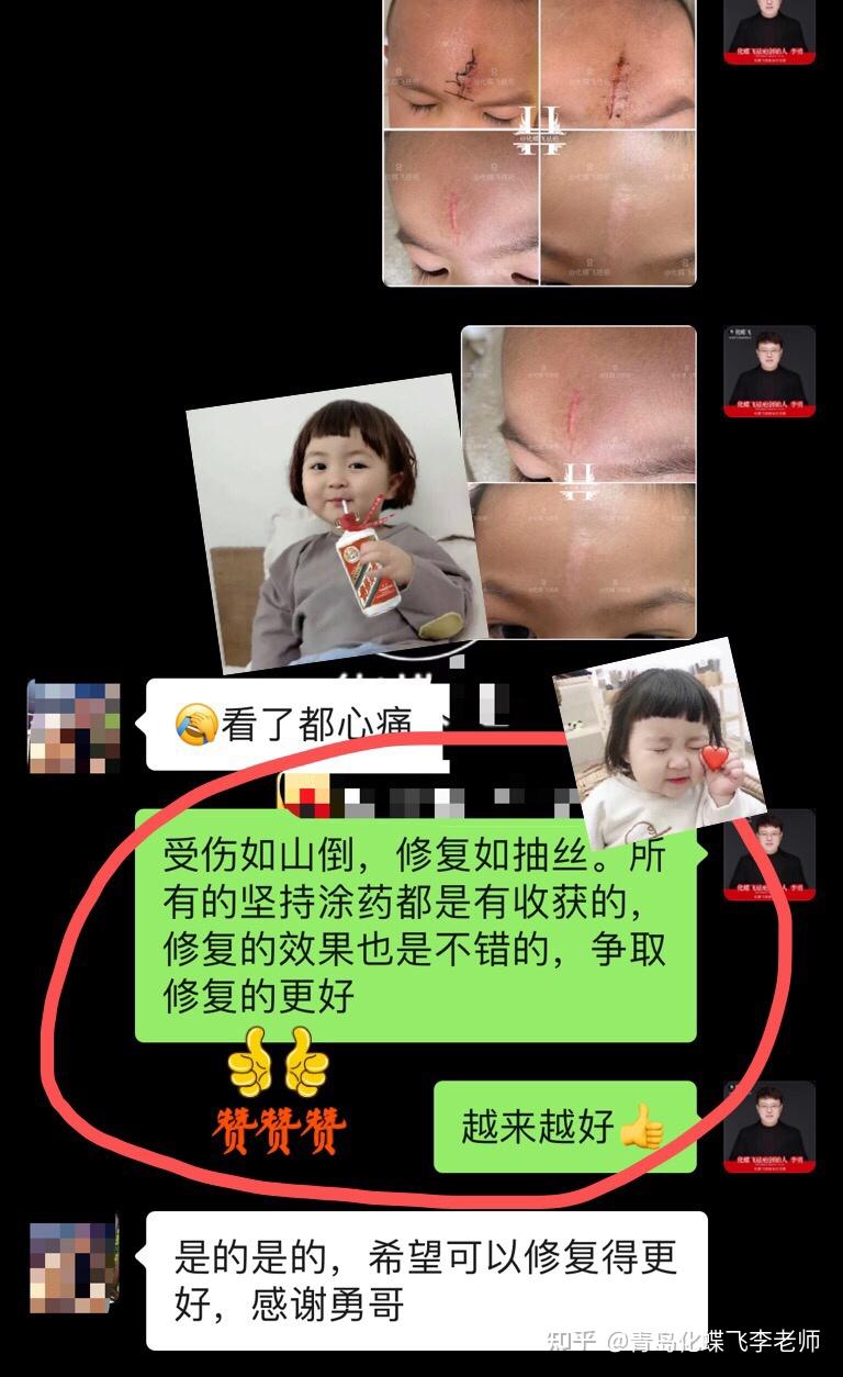 宝宝磕伤额头修复全过程 - 知乎