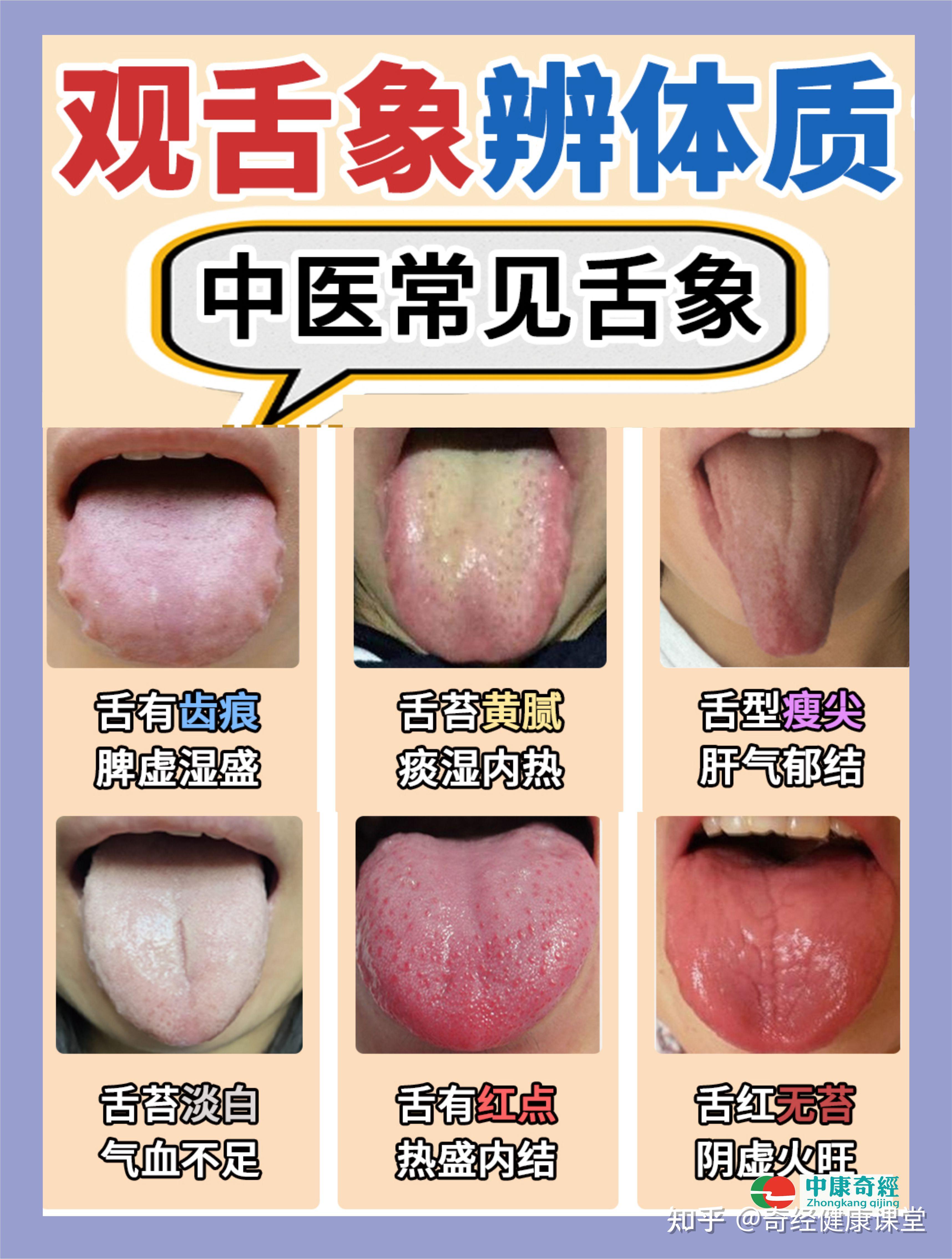 真人舌像自测表，看看你是属于哪一种？ - 知乎