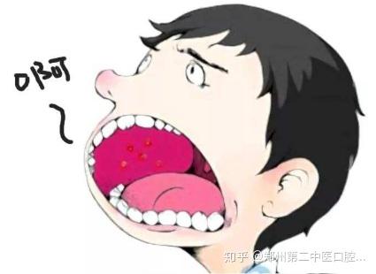 经常口腔溃疡是什么原因 怎样预防口腔溃疡 - 知乎