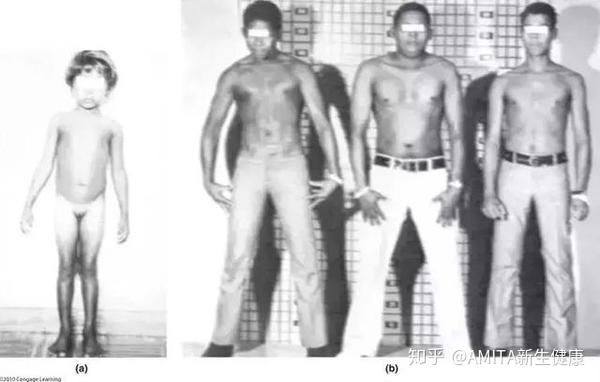 Xxy Or Xyy 带你走进真实的 第三性别 群体 知乎