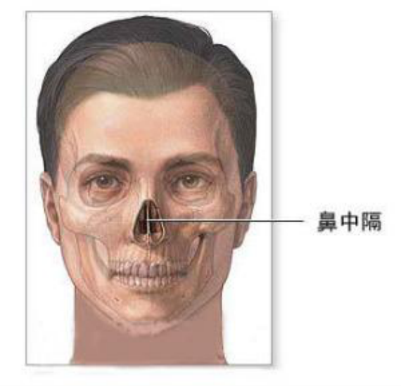 鼻整形常用的鼻中隔软骨取了会塌吗