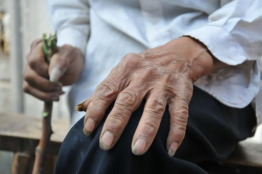 v2-432528331b057678b1b0c30df707fc5e_1440w.jpg?source=172ae18b