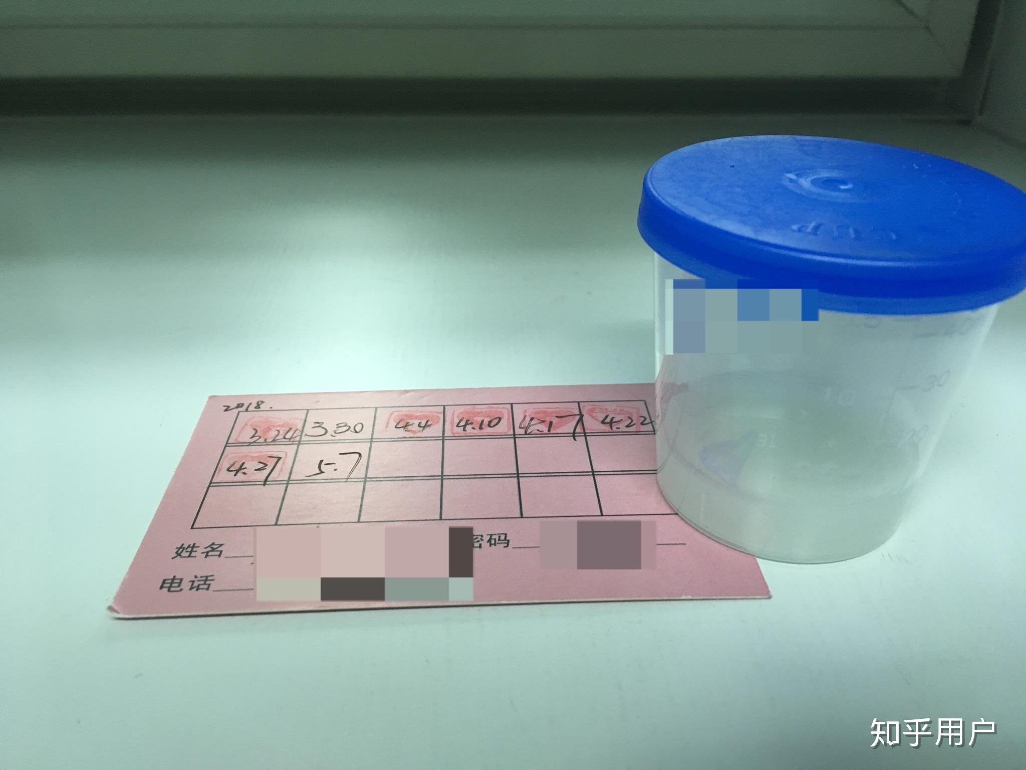 捐精是一种怎样的体验?