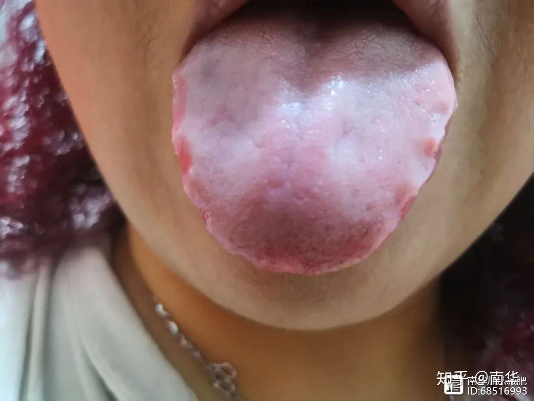 南华加法减肥之解决脾胃虚寒的超实用食疗法