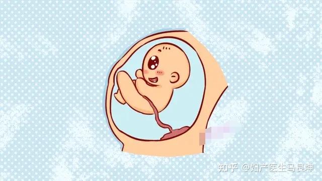真相揭秘！胎动位置可分辨男女？关于胎动的学问一篇带你了解清楚 - 知乎