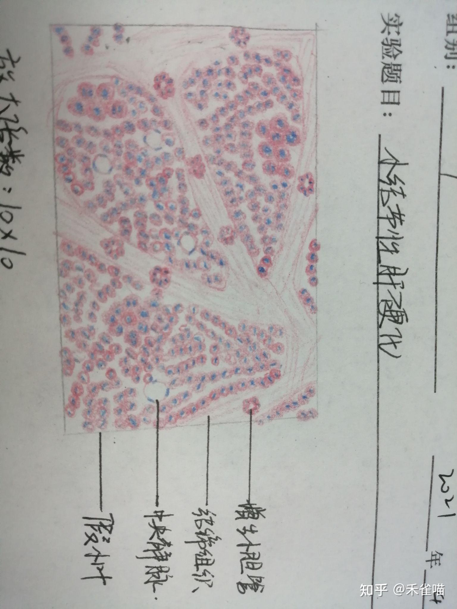 槟榔肝切片绘图图片