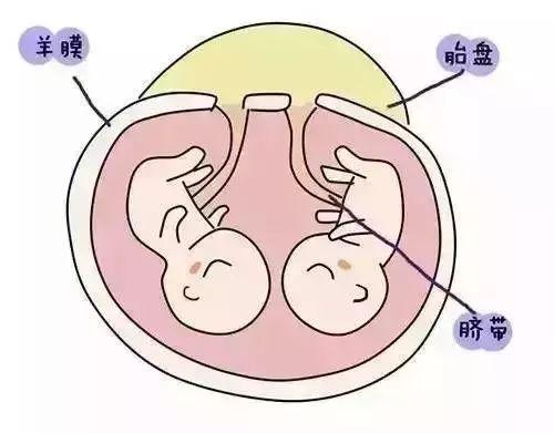 双胞胎是怎么形成的?终于弄明白了 - 知乎