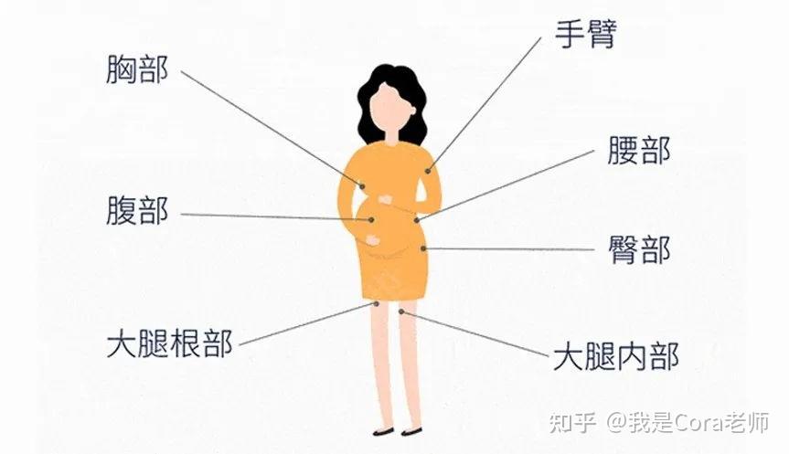 为什么大腿长妊娠纹?原来妊娠纹不是肚子的专属纹身