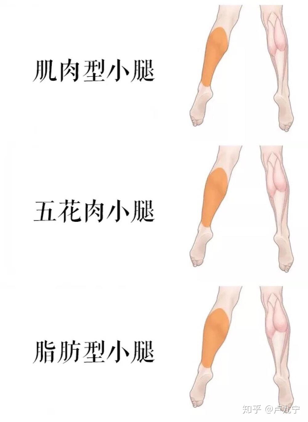 肥肉型,五花肉,肌肉型,你属于哪种腿型?