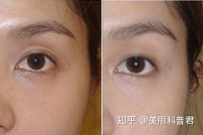 怎样让全身皮肤变紧致 v2-439f4a548de1af72c30e0b0e73801913_b.jpg