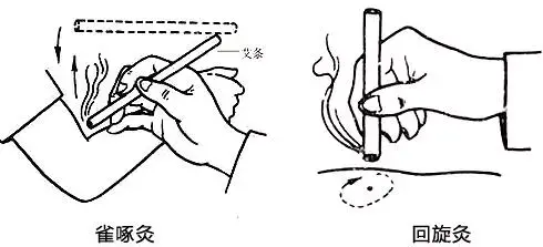 回旋灸:点燃艾条,将艾条悬浮于施灸部位上方2-3公分,左右移动往返回旋