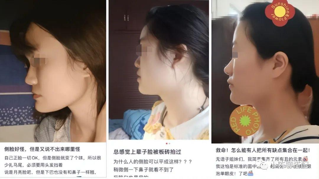 “扁平脸”有多影响颜值,80%亚洲人都有的颜值短板,要如何逆袭 - 知乎