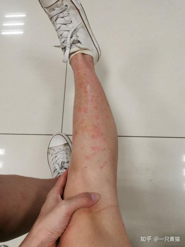 美团民宿预订房间给了我有生锈锅和蟑螂的民宿