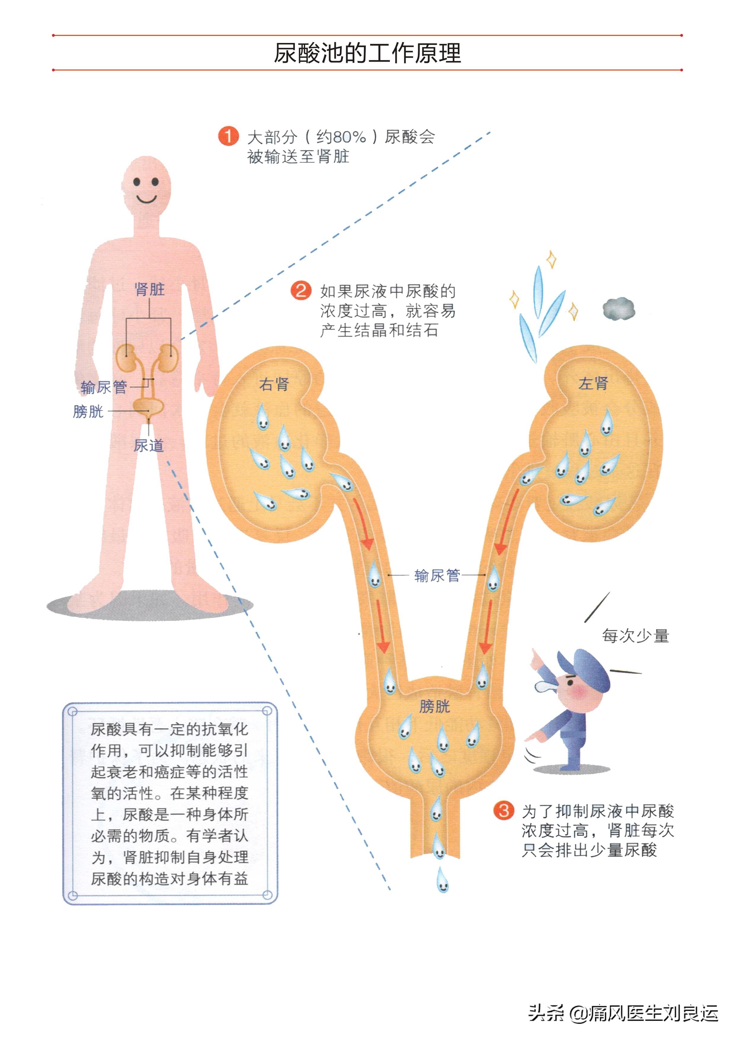 痛风定胶囊降尿酸原理图片