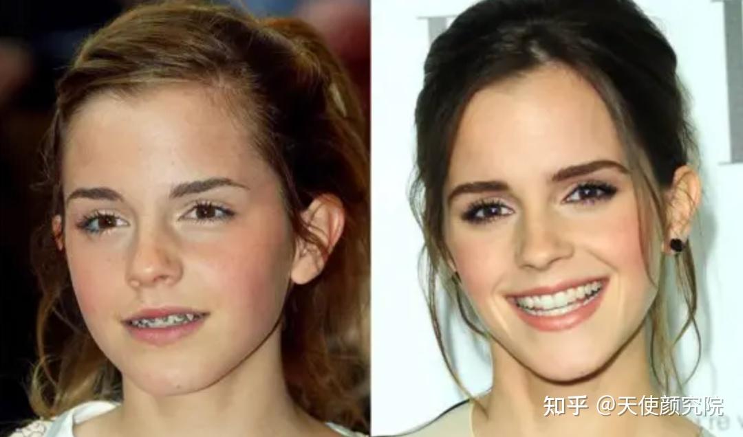 郑秀妍这段太蛊了吧!芒果台怎么能删了不播??!(郑秀妍签约英皇)