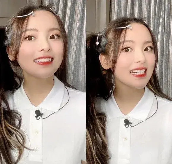 黄牙问题杨超越不是个例,李沁以前也一样.