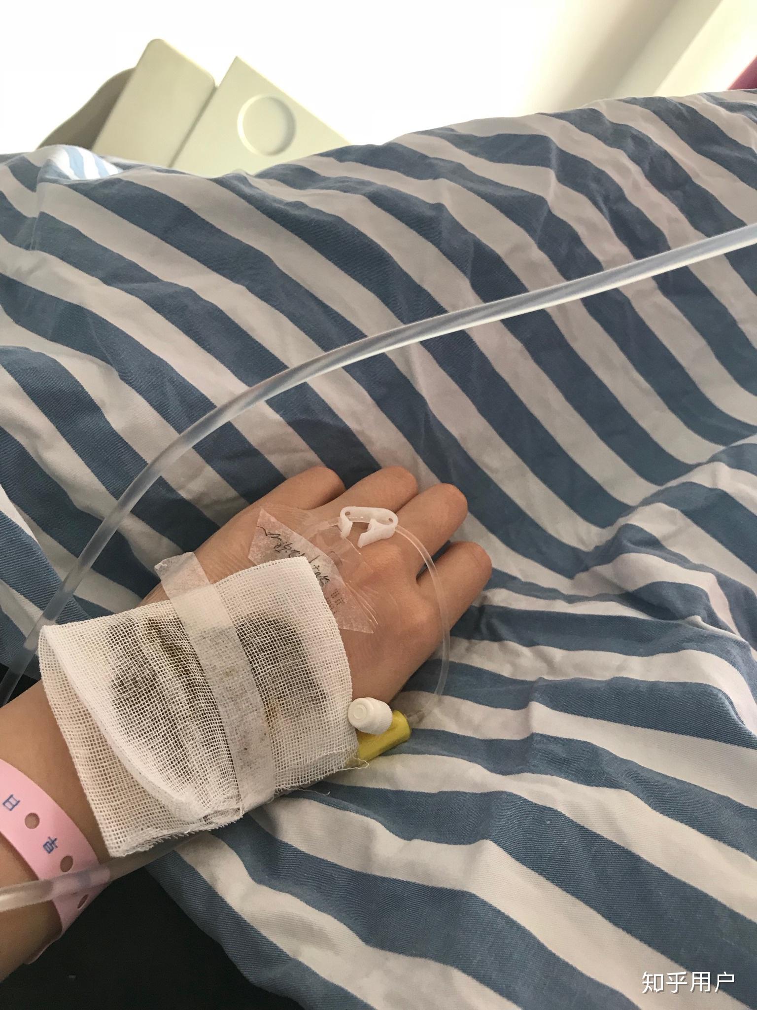 药流好还是人流好?什么时候流掉好?