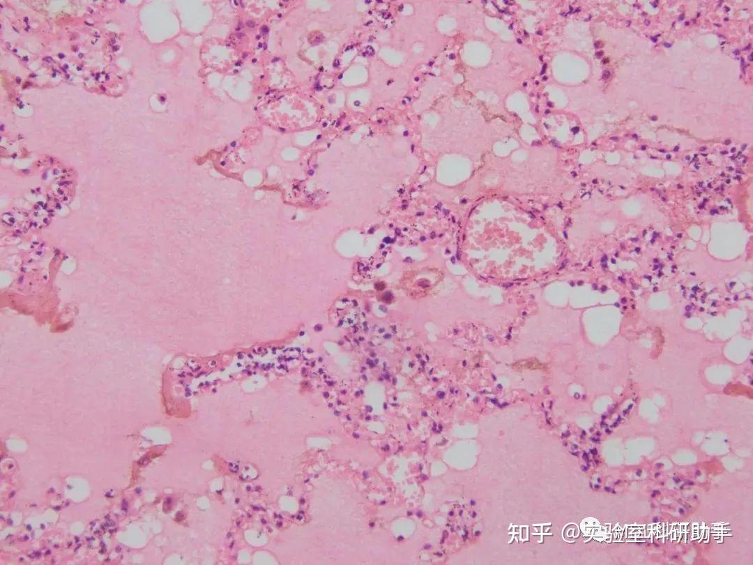 切片学习 | 常规病理组织切片及诊断要点 - 知乎