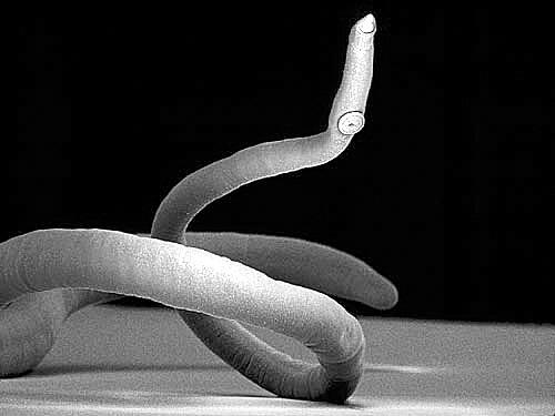 猫咪体内最长长长长的寄生虫-绦虫