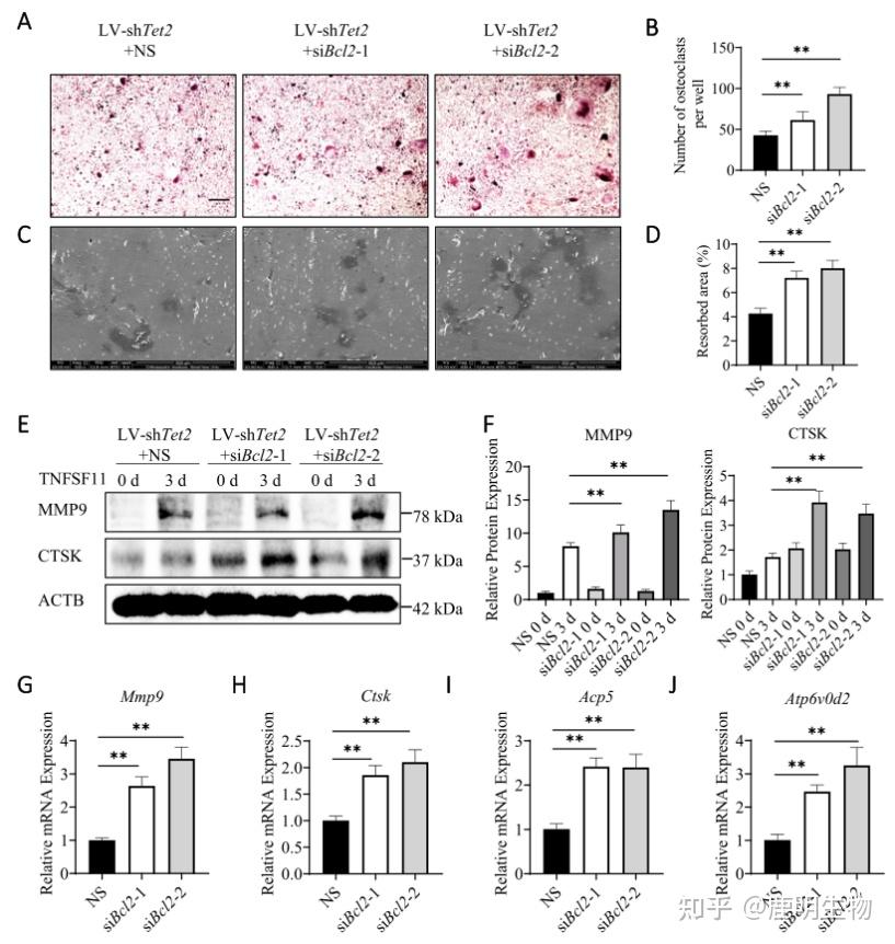 运用转录组测序探究骨质疏松对破骨细胞活化和骨量流失的研究
