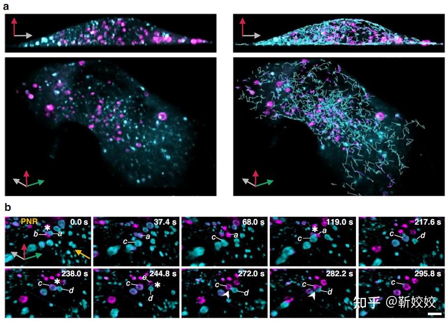 【Nat Commun】3i晶格光片显微镜辅助构建全细胞层面的内体（endosome）群体成熟模型 - 知乎