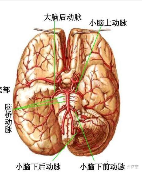 基底动脉尖综合征图片