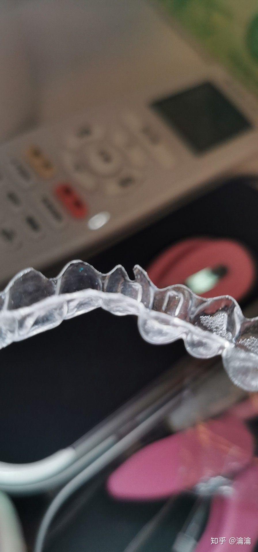 隐形牙套第一天