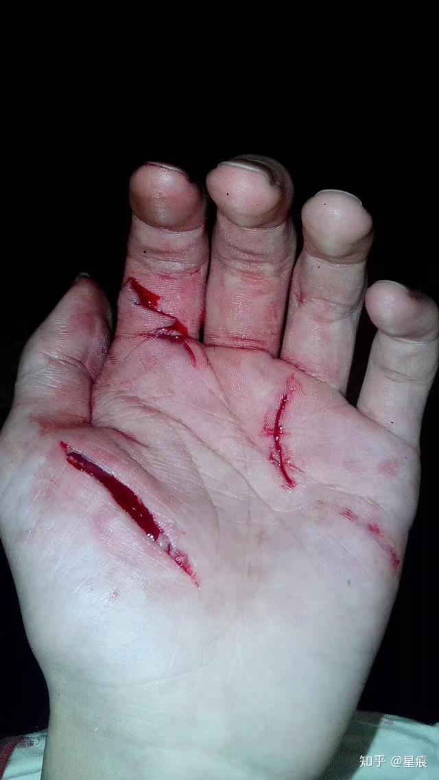 有哪些看着就很疼的照片/视频?