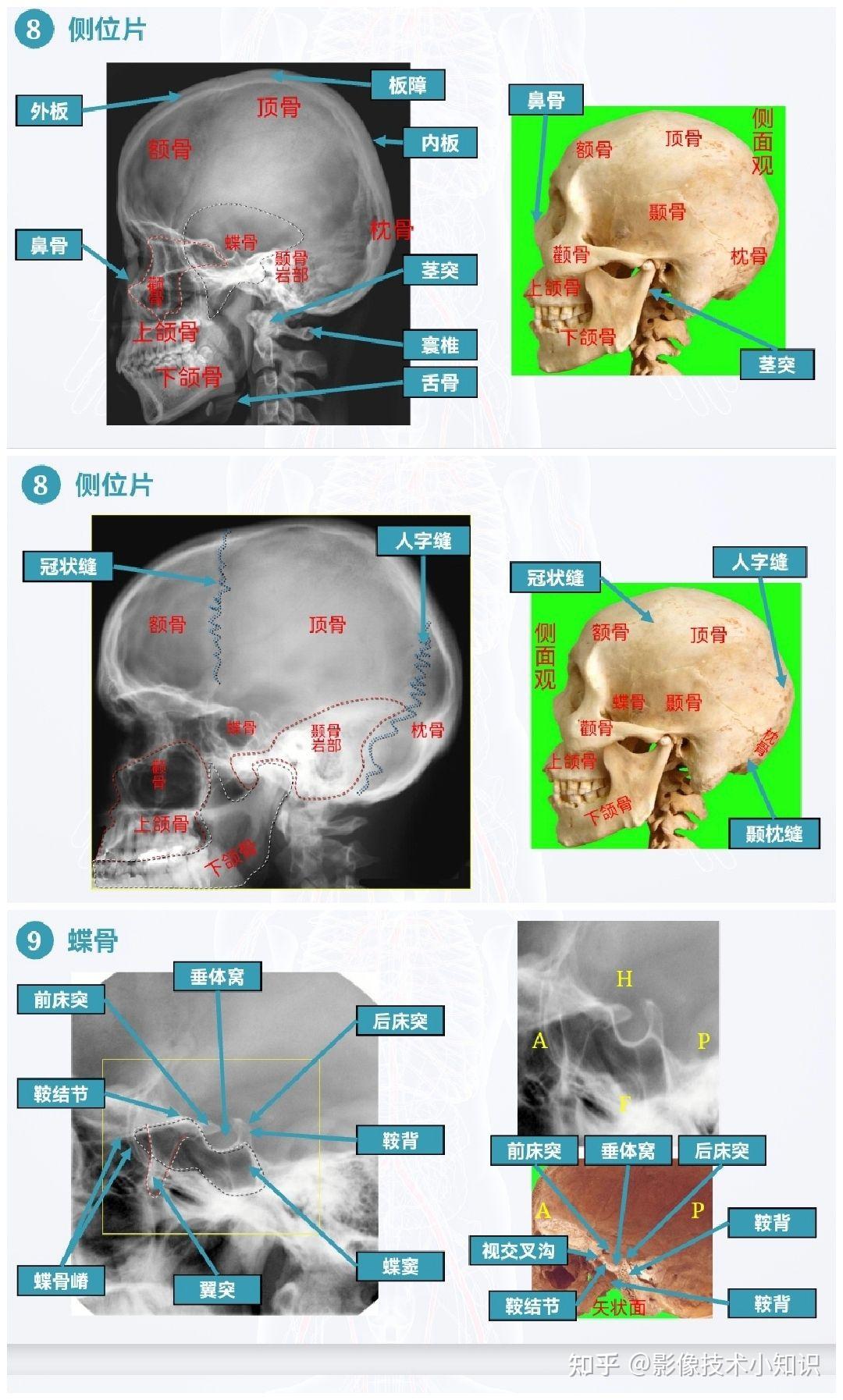 19.颅底(内面观)-系统解剖学动画感-医学