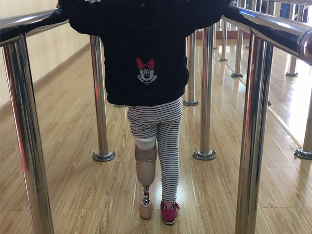 安装多久可以行走?云南晟康假肢为你解答