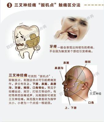 牙痛和三叉神经痛的区别是什么
