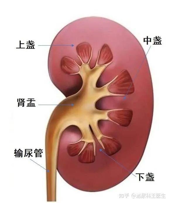 倒立或臀膝位这种排石方式适合结石位于肾脏下部,下盏结石的患者,在