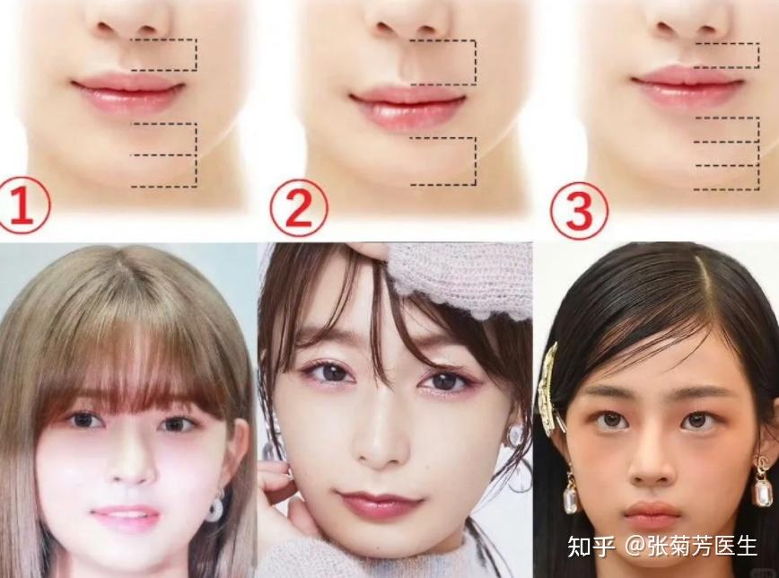 do唇前必看“唇部美学解析 - 知乎