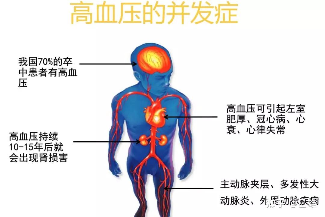 高血压生活管理指南,涉及方方面面!收藏! - 知乎