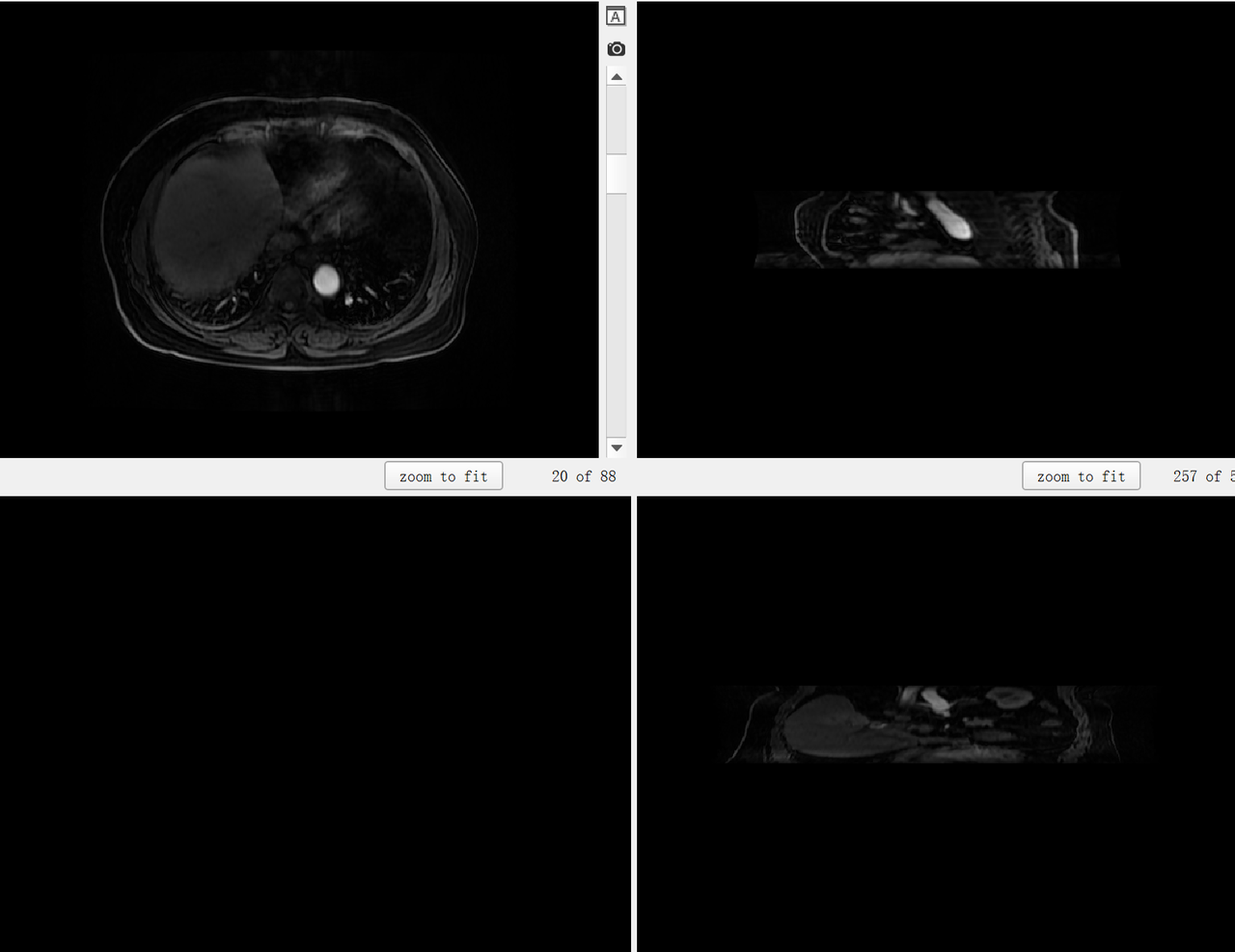LLD-MMRI2023 多相位MR肝脏病变诊断数据集介绍 - 知乎