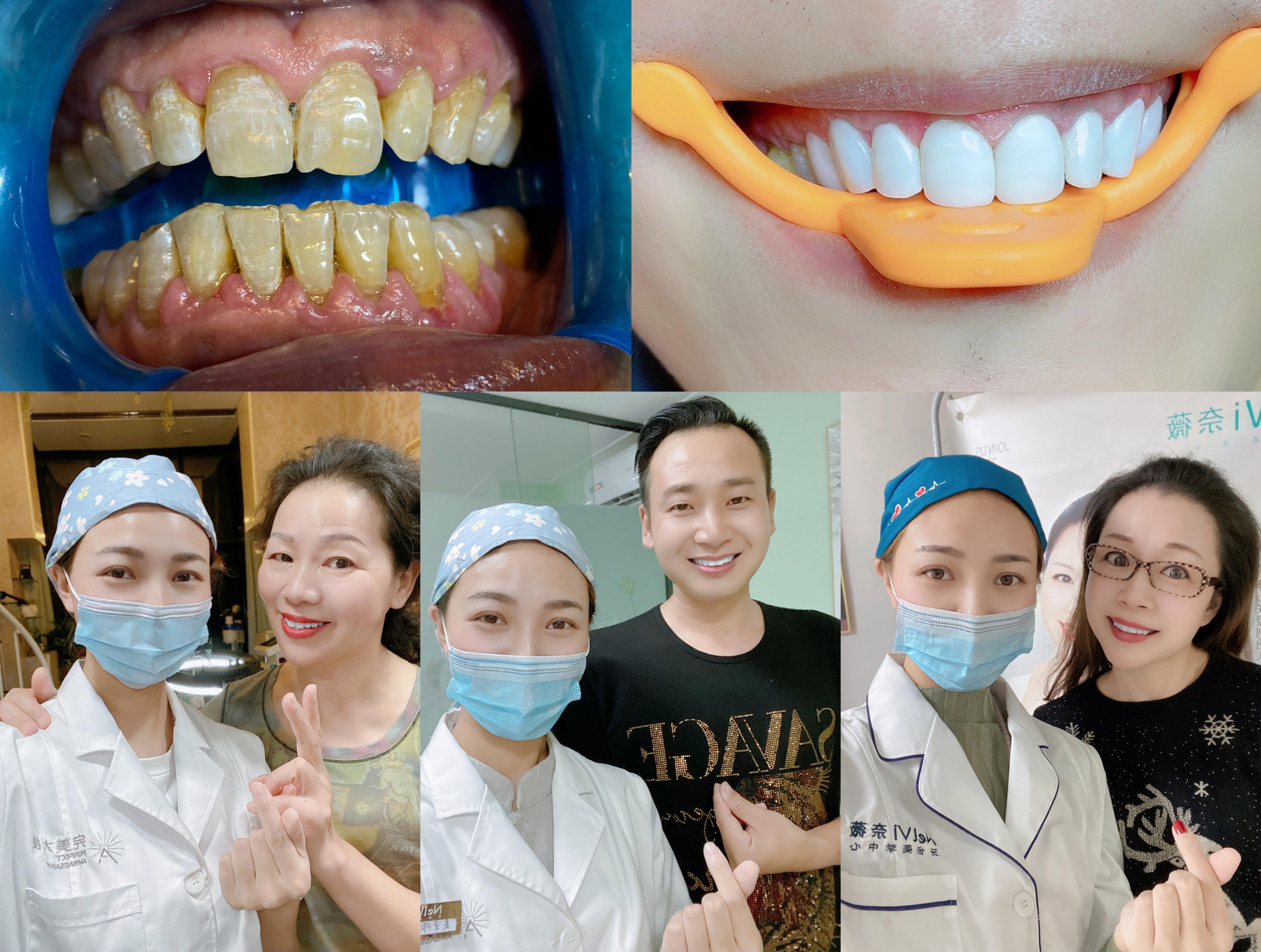 用微笑书写理想原来美丽人生如此简单美牙师企业家陆明明女士