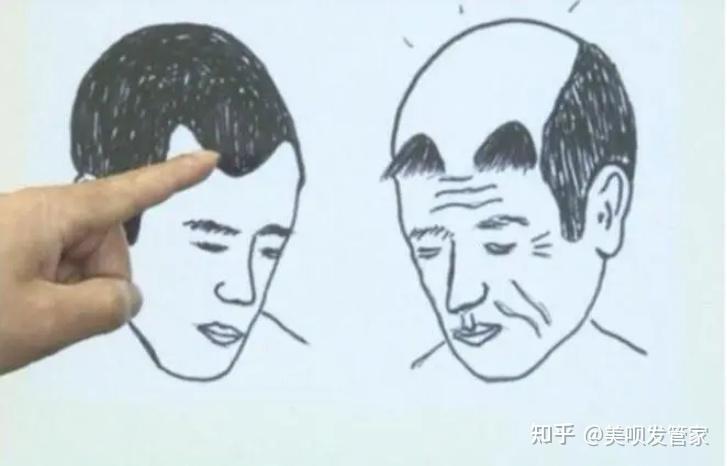 植发加盟陷阱图(植发加盟费是多少)