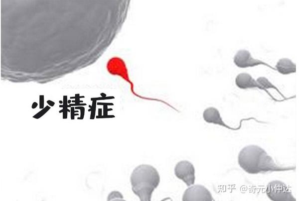 少精可能是由什么原因引起的？ - 知乎