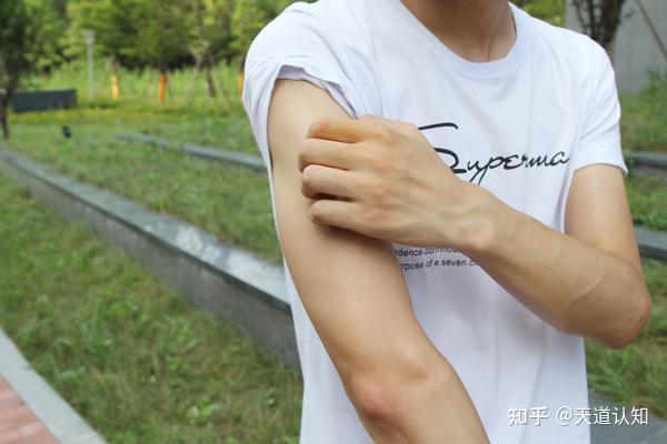 鸡皮肤是不是不容易出汗(经常锻炼出汗对鸡皮肤好吗)