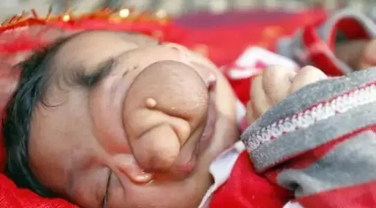 pfoa不粘锅涂层中的活性剂毒性极大可引发肿瘤