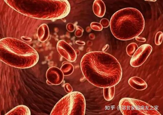 溶血性贫血之遗传性球形红细胞增多症 - 知乎