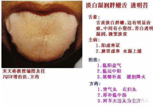 高清舌诊图解:各种临床证型舌象图谱大开眼界 - 知乎