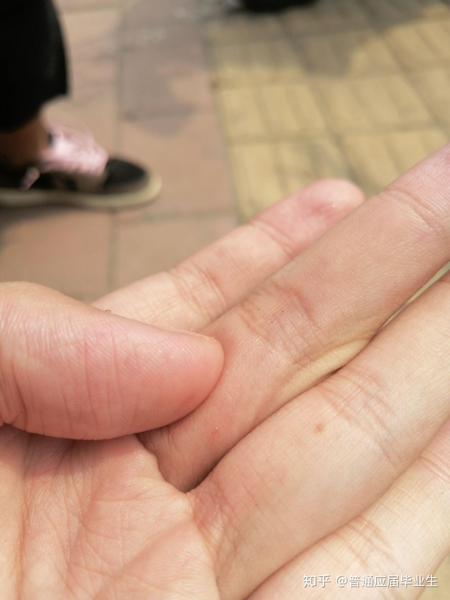 被猫抓伤打疫苗不能吃什么 v2-463def7a1d3a3d33bc6ce8078ca08303_r.jpg