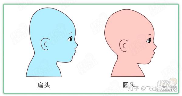 娃偏头扁头会伴随一生专家千万别错过矫正黄金期
